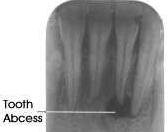 Dental X-rays in the Land of Oz