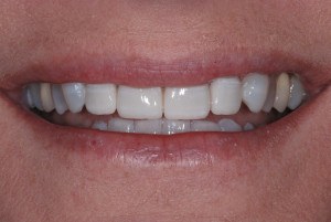 Back To The Future! Sometimes Moving Forward Means Going Back