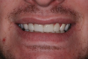 Of Teeth And Starfish: Changing The World, One Smile At A Time