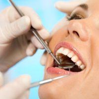 Back to the Basics: The Importance of a Prophy